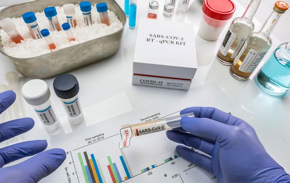 PCR, qPCR & Genexpressionsanalyse