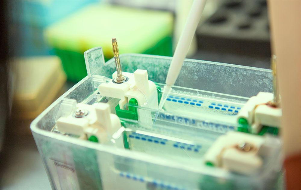 Western Blot & Proteinanalyse
