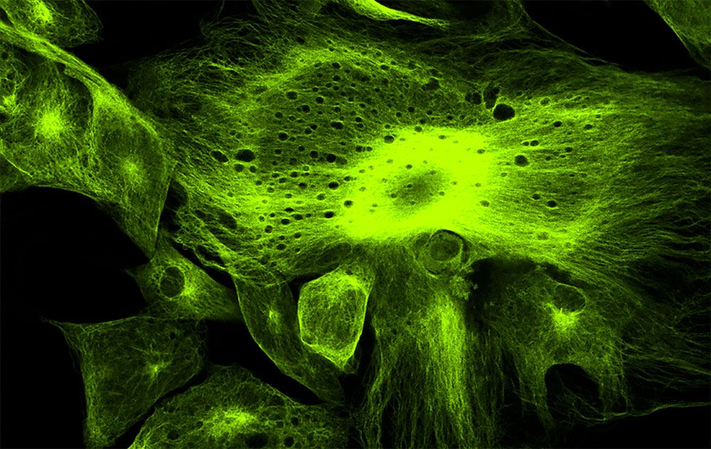 Immunfärbung & Mikroskopie